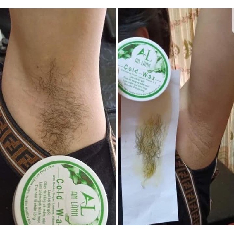 Wax Lông An Lành (Tặng 50 Tờ Giấy + 2 Que Wax ) | BigBuy360 - bigbuy360.vn