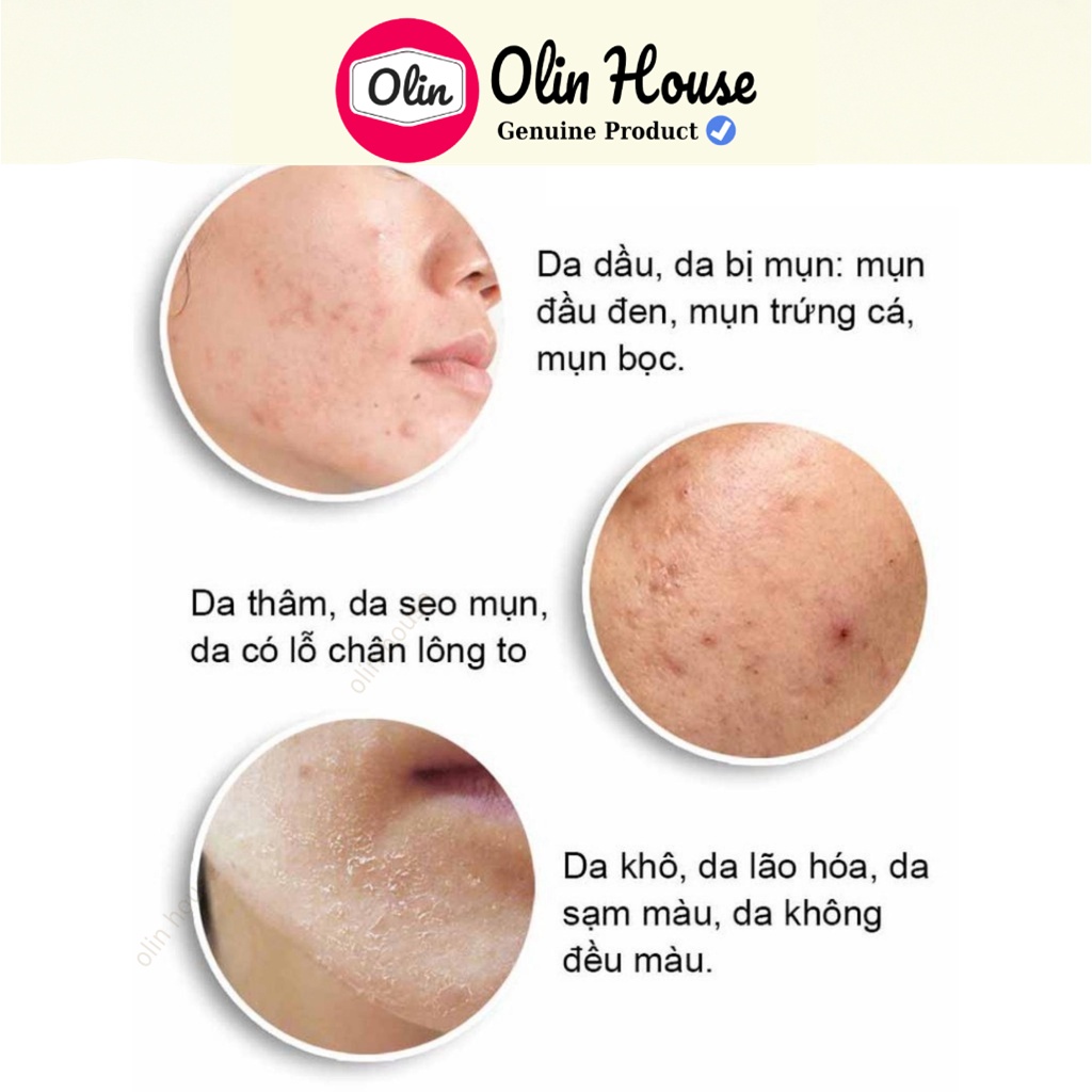 Tinh chất Serum The Ordinary Niacinamide 10% + Zinc 1% giảm mụn, thu nhỏ lỗ chân lông - Olin House