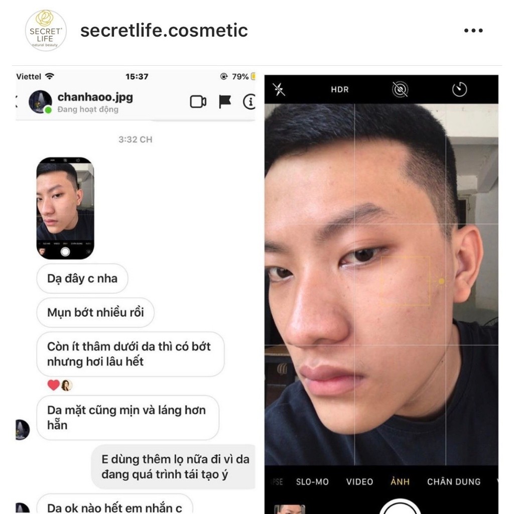 Serum Secret Life🌸FREE SHIP🌸Ngăn Ngừa Mụn, Dưỡng Da, Se Lỗ Chân Lông, Sáng và Làm Đều Màu Da