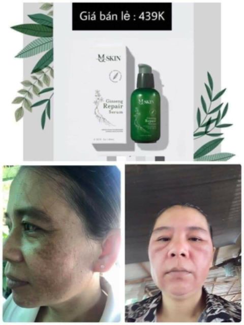 M-QSKIN NHÂN SÂM