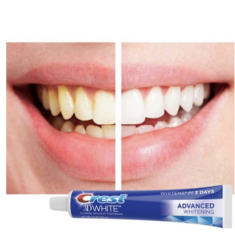 Kem đánh răng Crest 3D White Advanced Whitening 170gr và Vivid Mint 150gr Mỹ - Trắng răng / Chống ê buốt, sạch mảng bám