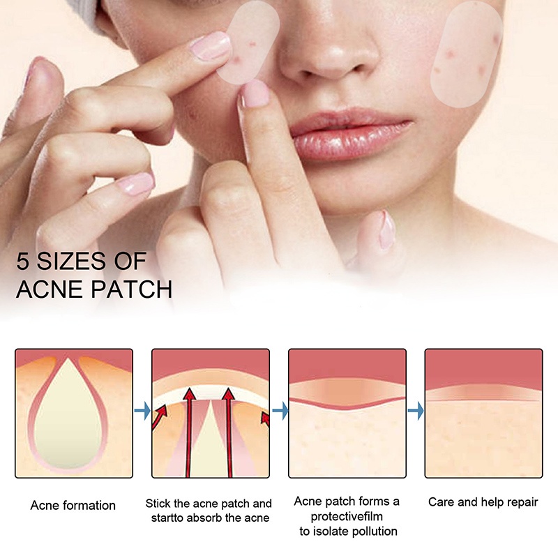 Miếng Dán Hỗ Trợ Giảm Mụn Vô Hình / Nhiều Kích Thước / Chống Thấm Nước Cải Thiện Tình Trạng Mụn Mặt