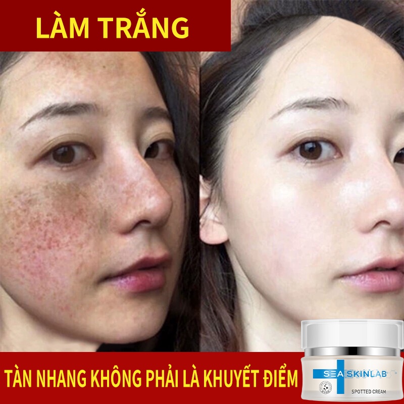 SEA Sem tàn nhang chính hãng Loại bỏ tàn nhang sâu, làm sáng, trắng da, chức năng kép kem tàn nhang hiệu 30G