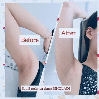 siêu dưỡng thâm 5s Biho ladi