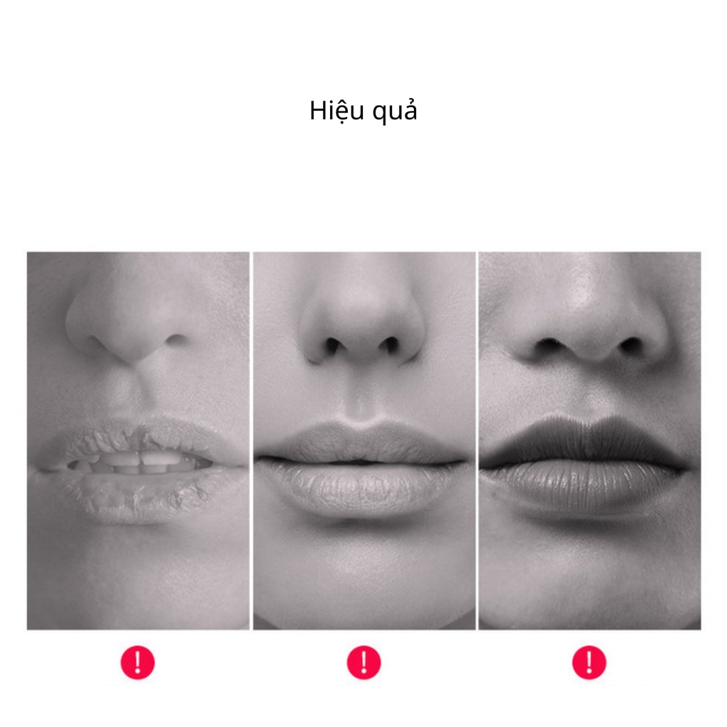 Mặt nạ dưỡng môi collagen CHERRY nội địa Trung HOUMAL giảm thâm làm hồng dưỡng ẩm môi nội địa Trung