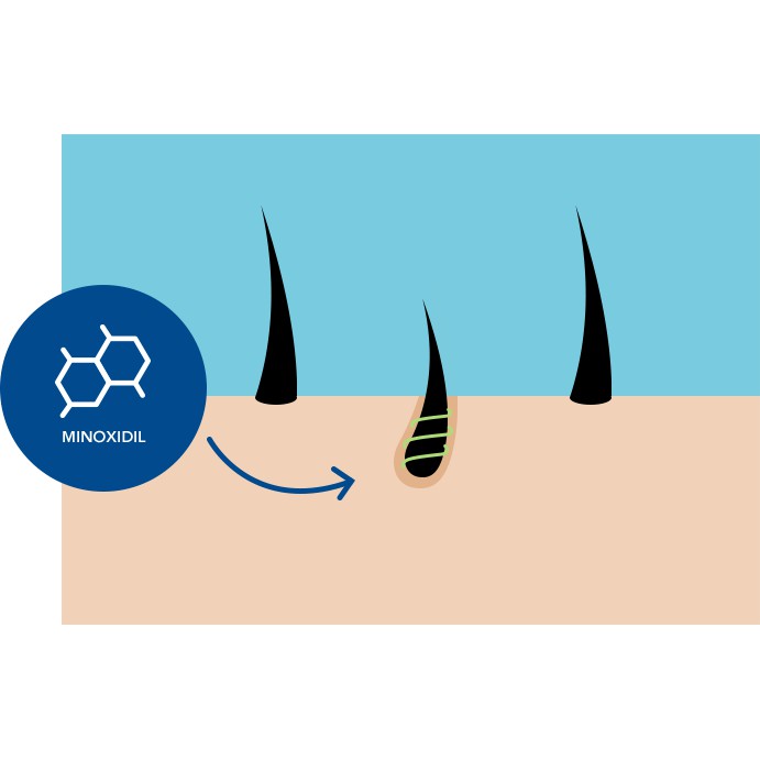 Minoxidil 5% Rogaine men's foam nguyên hộp 3 chai