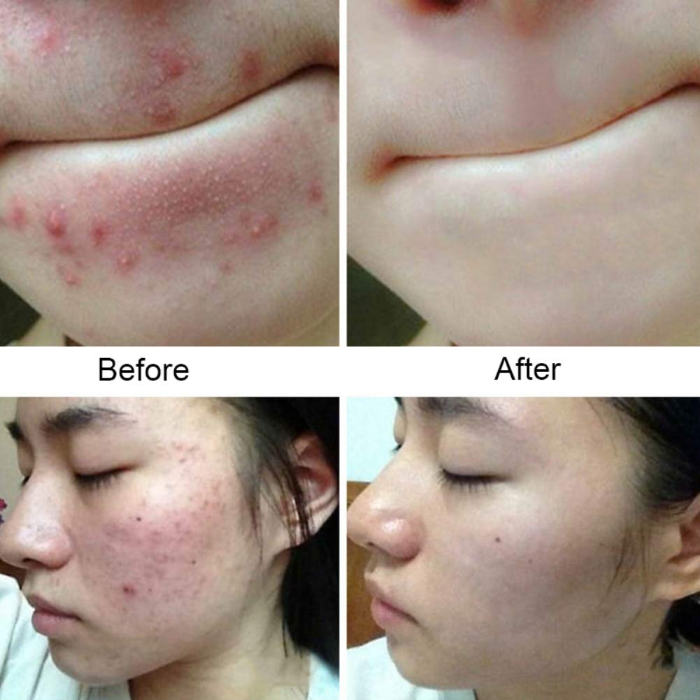 1 Xà Phòng Sữa Dê Tự Nhiên Hỗ trợ giảm mụn Dưỡng Ẩm Thu Nhỏ Lỗ Chân Lông