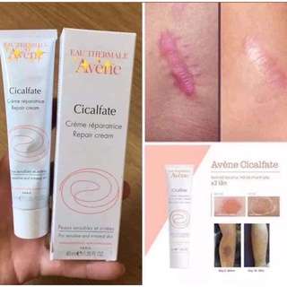Kem dưỡng phục hồi Avene Cicalfate