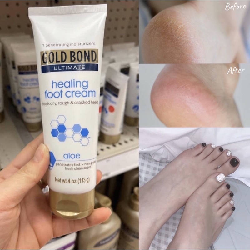 AUTH - SALE OFF KEM DƯỠNG MỀM MỊN DA CHÂN GOLD BOND ULTIMATE HEALING FOOT CREAM