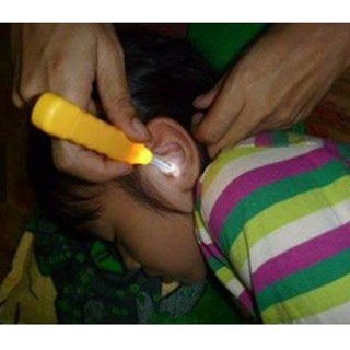 Dụng cụ lấy ráy tai có đèn- mẫu mới