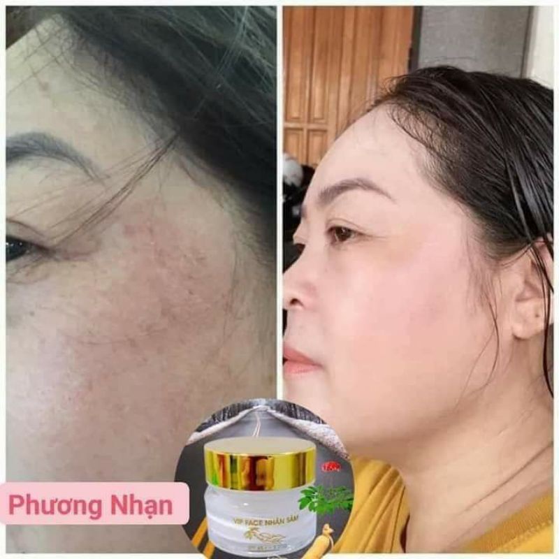 ViP FACE NHÂN SÂM DƯỠNG TRẮNG DA