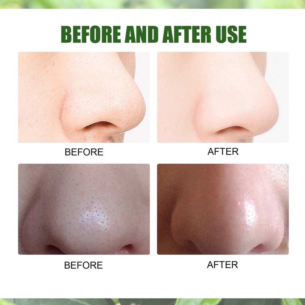 EELHOE Serum Mặt Thu Nhỏ Lỗ Chân Lông Kiểm Soát Dầu Trà Xanh Loại Bỏ Vết Thâm Cải Thiện Mụn Đầu Đen Chăm Sóc Da Khô-Ampere