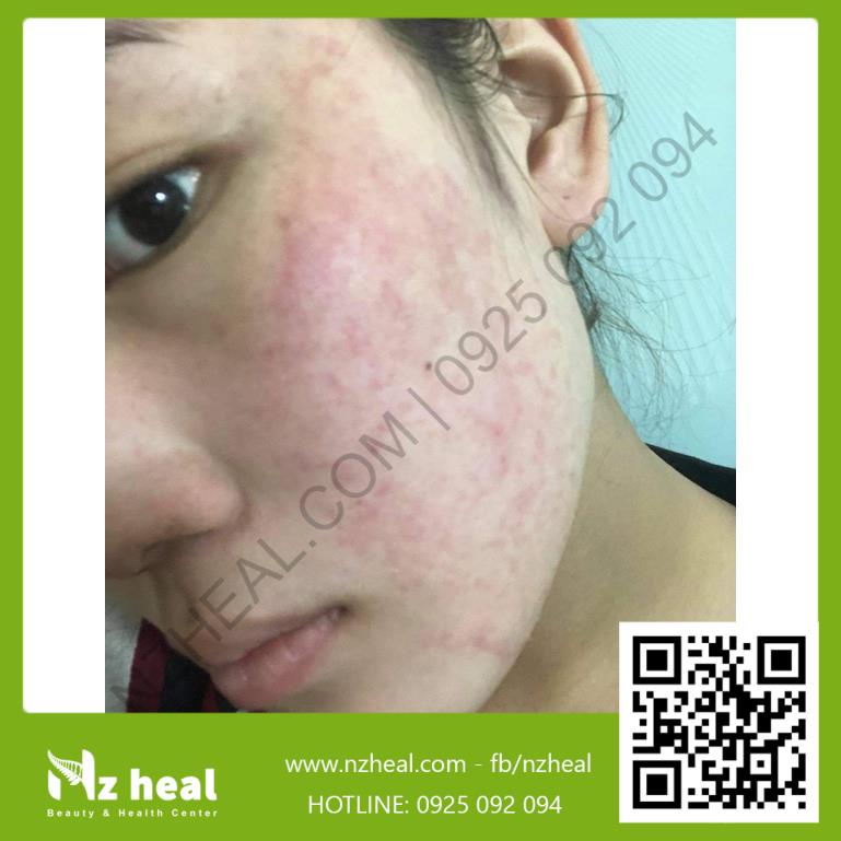 [Hỏa tốc] Kem Mật Ong Manuka 16 Skin Health Madeleine Ritchie 80ml