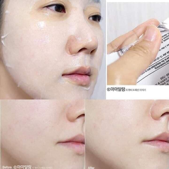 Banobagi, Mặt nạ Banobagi Stem Cell Vitamin Mask 30ml