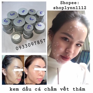 ❤️Kem chấm vết thâm dầu cá Hoặc 10 que chun màu niềng răng và kem chấm vết thâm dầu cá