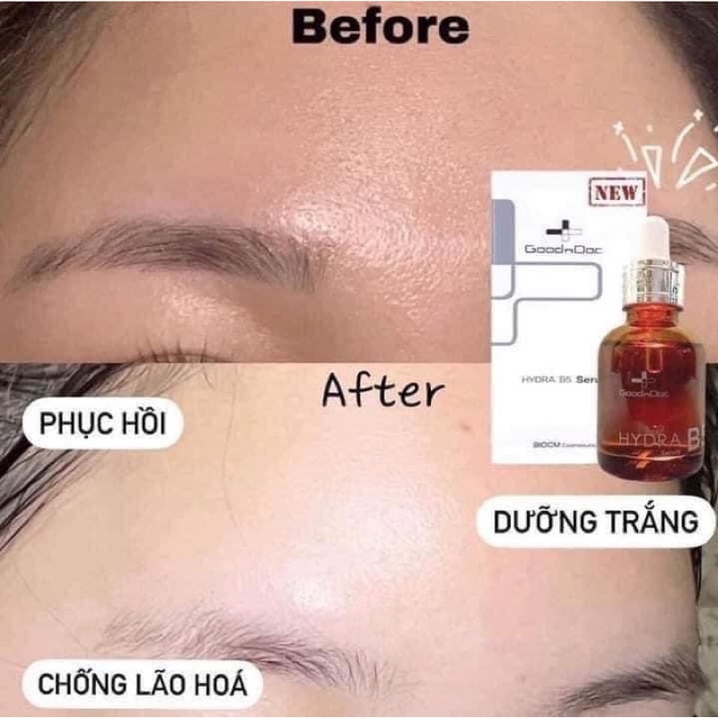 Tinh chất phục hồi da Goodndoc B5 + Vitamin C Serum Hàn Quốc