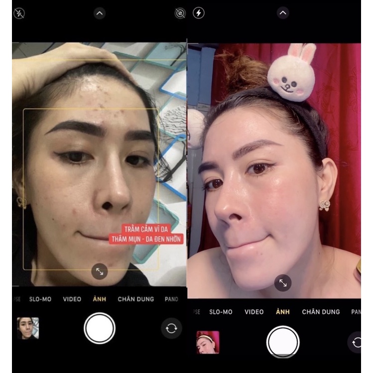 ⭐TÁI TẠO DA HỒNG SÂM⭐️CHÍNH HÃNG CÔNG TY