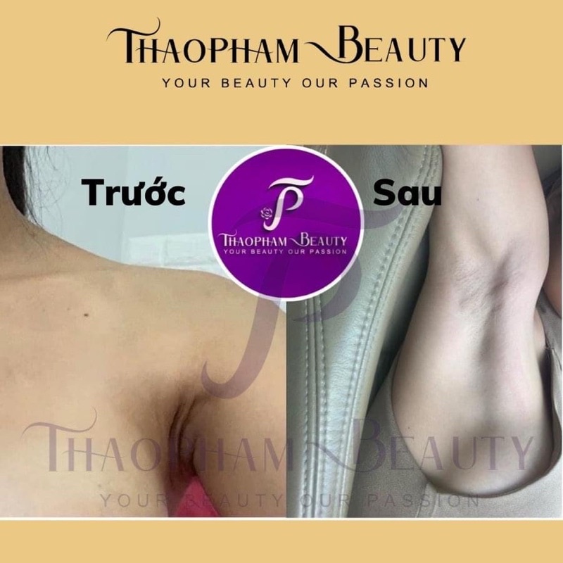 Tẩy tế bào chết thảo mộc nghệ Body Black Tumeric Scrub Keva 300g – Thảo Phạm Beauty