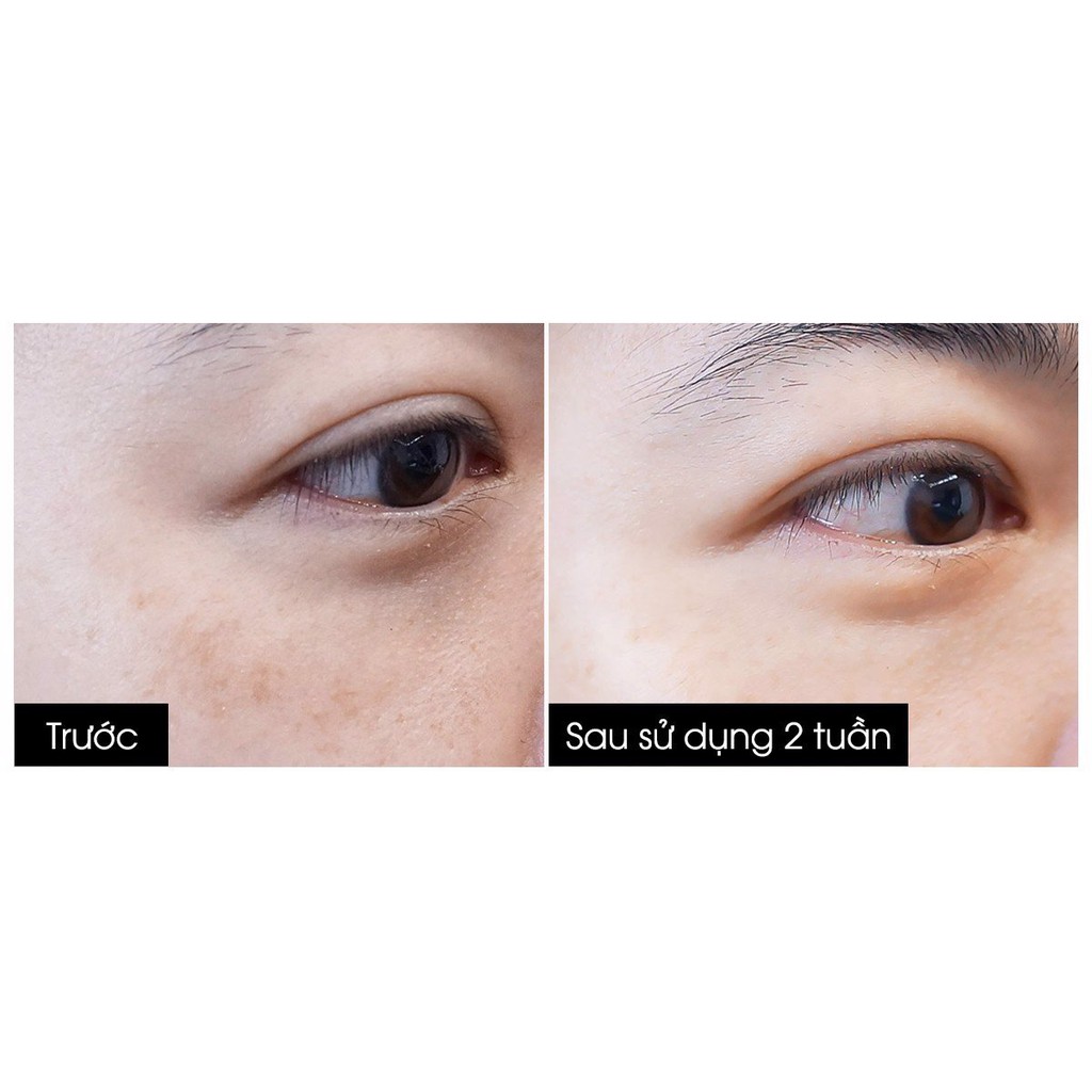 [ĐỌC KỸ MÔ TẢ] Kem dưỡng chống thâm, nhăn vùng mắt chiết xuất từ dịch ốc sên Mdmmd (nội địa Đài Loan) 40ml
