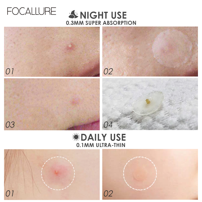 [Hàng mới về] Miếng Dán Mụn Focallure Hỗ Trợ Giảm Mụn Đầu Đen Ngày Và Đêm Tiện Dụng | BigBuy360 - bigbuy360.vn