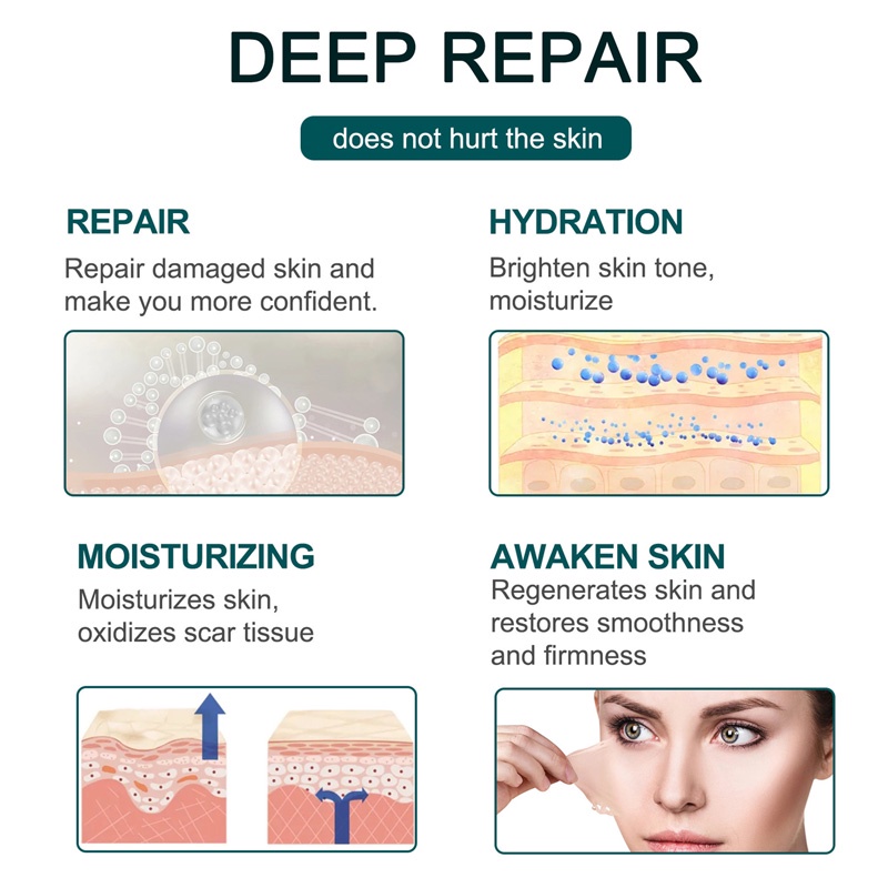 Miếng Dán Silicone Gel Hỗ trợ giảm sẹo Mụn Hiệu Quả ELAIMEI