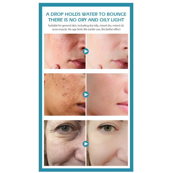 Tinh chất Hyaluronic Acid Mờ thâm nám - Thu nhỏ lỗ chân lông làm sáng da VIBRANT GLAMOUR VG