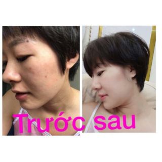 SỮA RỬA MẶT MAROSA LACO
