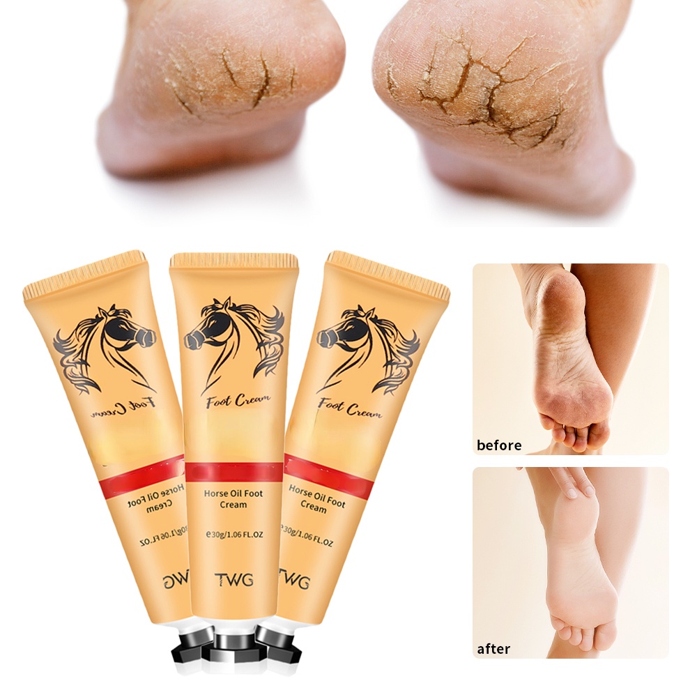 Kem Dưỡng Ẩm Da Chân Chống Nứt Nẻ Dành Cho Đi Du Lịch Ngoài Trời