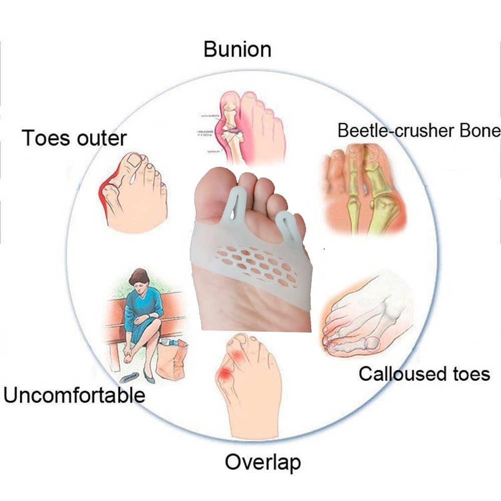 Dụng cụ tách ngón chân để giảm đau tiện lợi