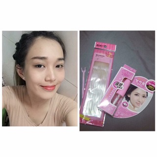 Kích mí lưới