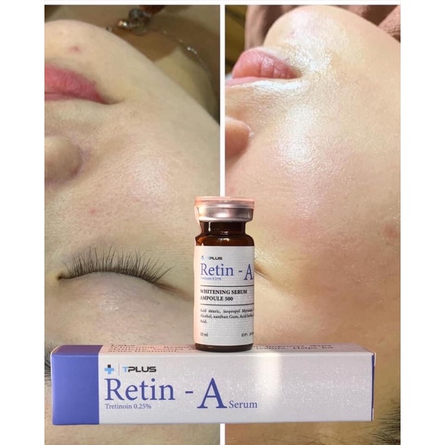 Retin-A tretinoin căng bóng trẻ hoá da