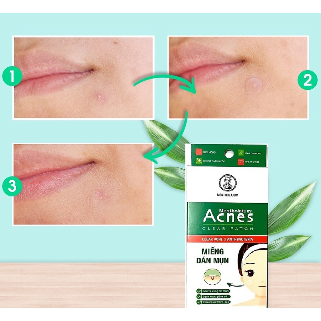 Hộp 24 miếng dán mụn Acnes Clear Patch - ngừa thâm mụn hiệu quả