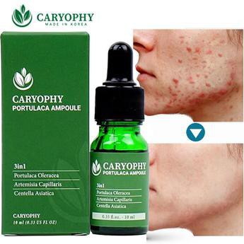 Serum ngăn ngừa mụn và thâm Caryophy Chính Hãng - Serum Mụn Ngăn Ngừa Mụn Ẩn,Mụn Đầu Đen | BigBuy360 - bigbuy360.vn