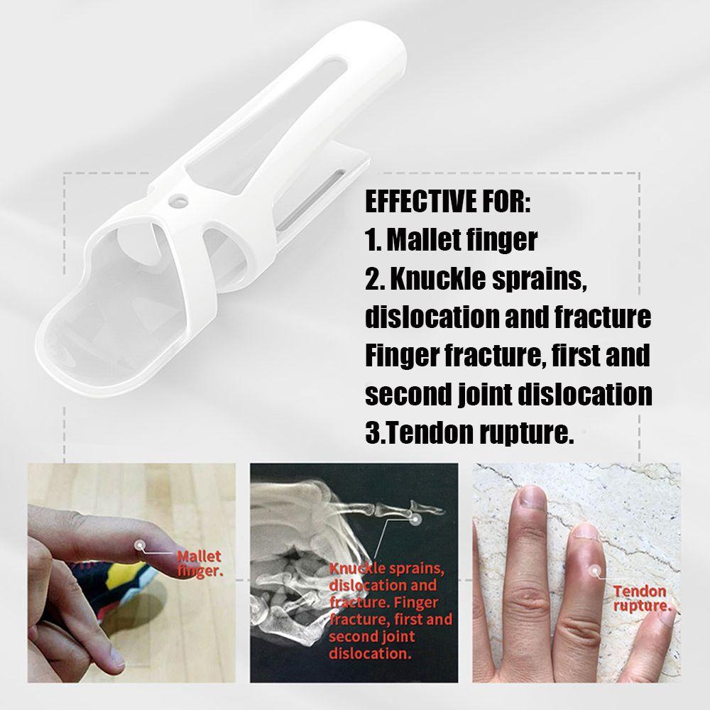 Nẹp Ngón Tay DARNELL Bảo Vệ Chống Chấn Thương Khi Chơi Thể Thao Cho Nam Và Nữ