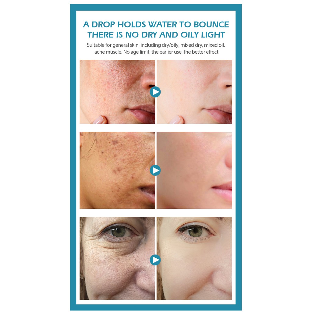 Tinh chất axit hyaluronic dưỡng ẩm hỗ trợ giảm mụn làm trắng da chống lão hóa dung tích 5ml | BigBuy360 - bigbuy360.vn