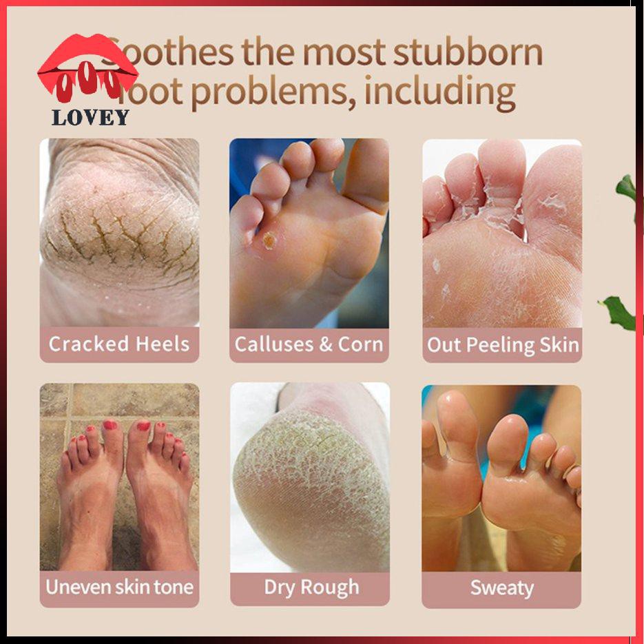 AUQUEST (Hàng Mới Về) Kem Dưỡng Da Tay Chân Chống Nứt Nẻ Thành Phần Thảo Dược Tự Nhiên 30g | BigBuy360 - bigbuy360.vn