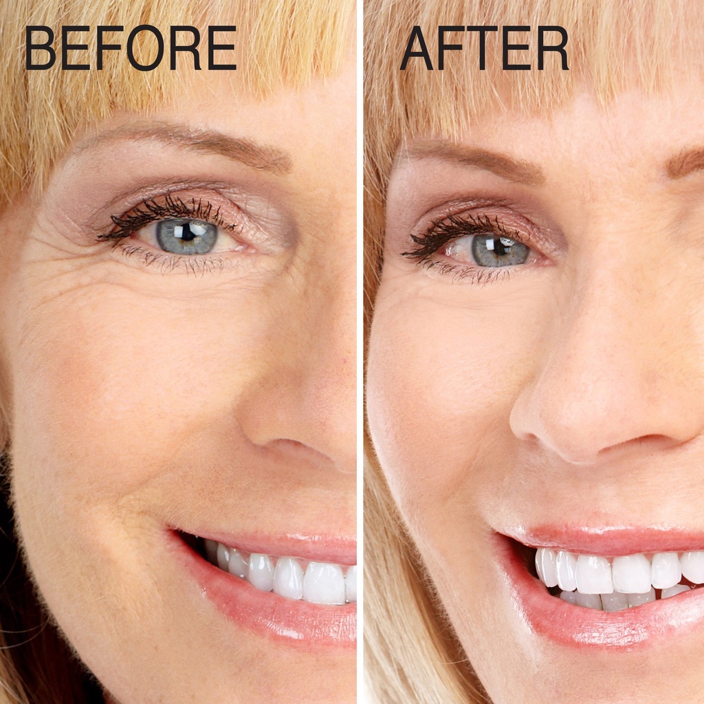 Serum Chống Lão Hóa Retinol Advanced Clinicals Anti-Wrinkle 52 ml