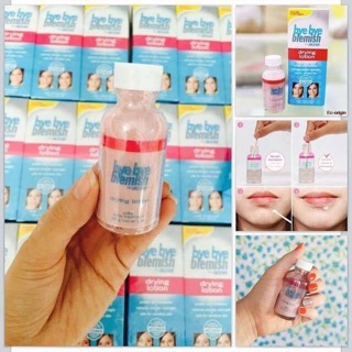 Lotion Chấm Xẹp Mụn Cấp Tốc Bye Bye Blemish Drying Lotion