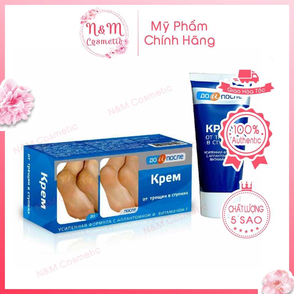 Kem Nứt Gót Chân Nga Kpem 50g