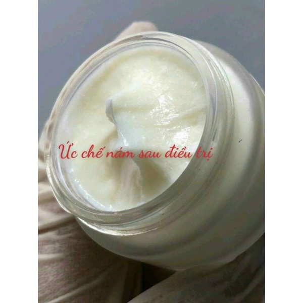 BỘ KEM NÁM SPA KHÔNG BONG