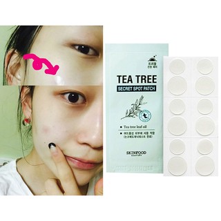 MIẾNG DÁN MỤN ANCE PIMPLE MASTER PATCH COSRX