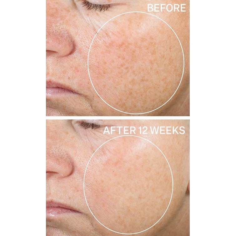 Serum Retinol + VitC của nhà StriVectin có chứa niacinamide