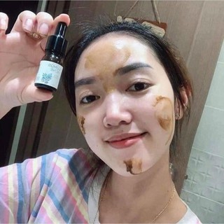 Serum Chữa Mụn LUMOS ACNE..