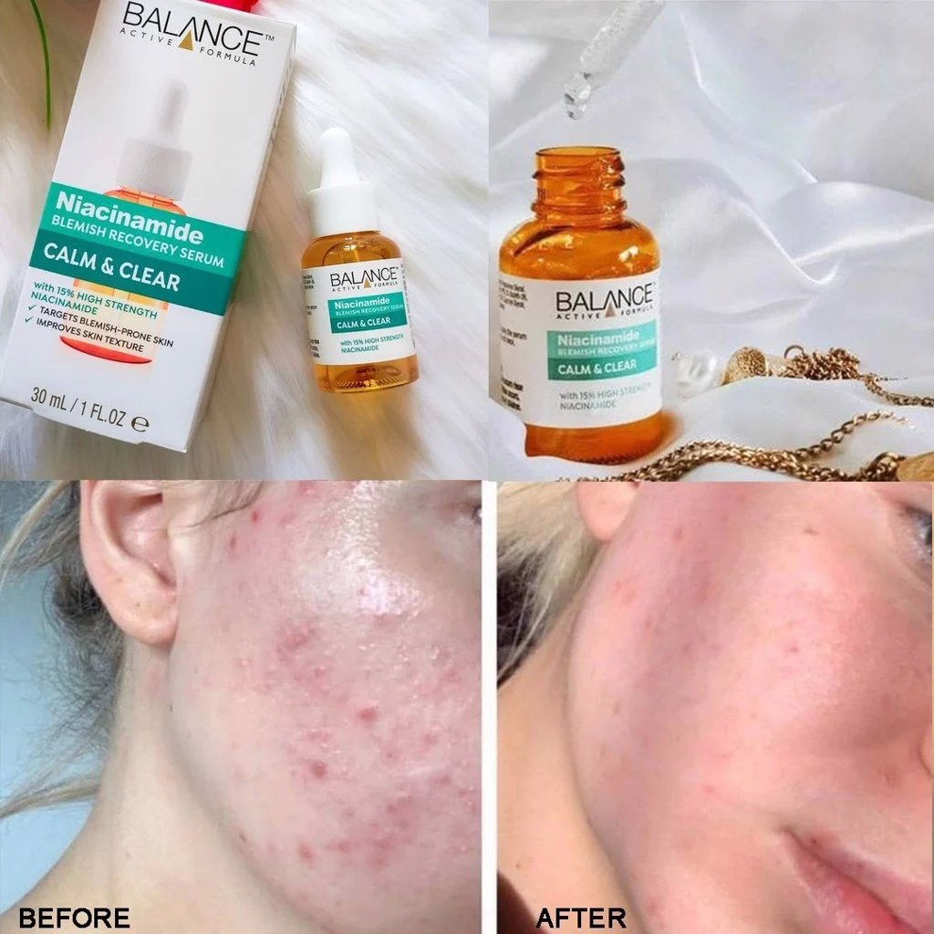 Serum Balance Niacinamide 15% Ngừa Mụn Mờ Thâm Sáng Da Blemish Recovery 30ml - Khongcoson