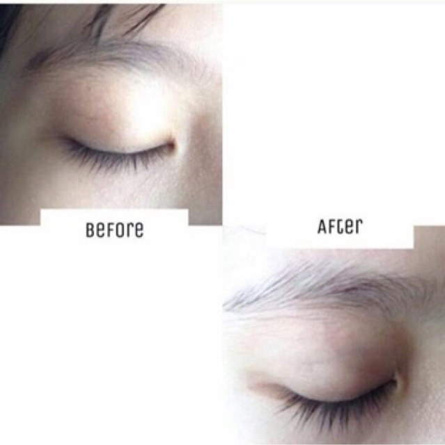 [FREESHIPPING] GELMICOCO DẦU DỪA NHA ĐAM - KÍCH MỌC MI | BigBuy360 - bigbuy360.vn