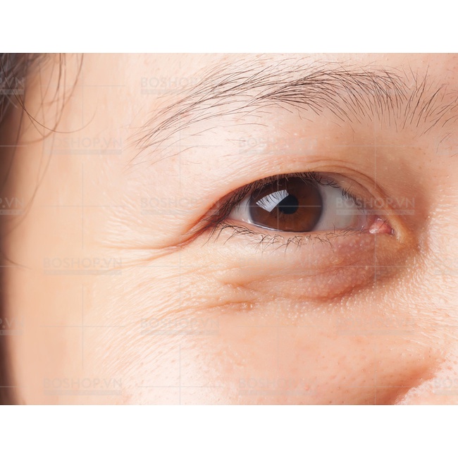 Kem Giảm Quầng Thâm Mắt Hadariki Kumargic DX Eye Cream 20g