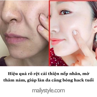 M27_Kem Retinal 1% Lumiderm màu ĐỎ