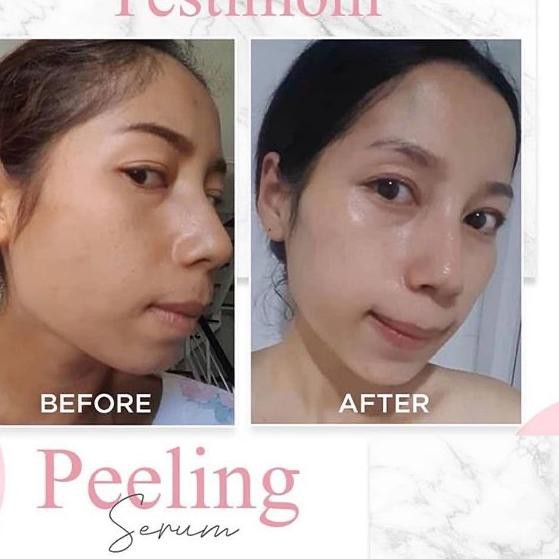 (Hàng Mới Về) Serum Dưỡng Da Mặt Today "Ms Glow Peel