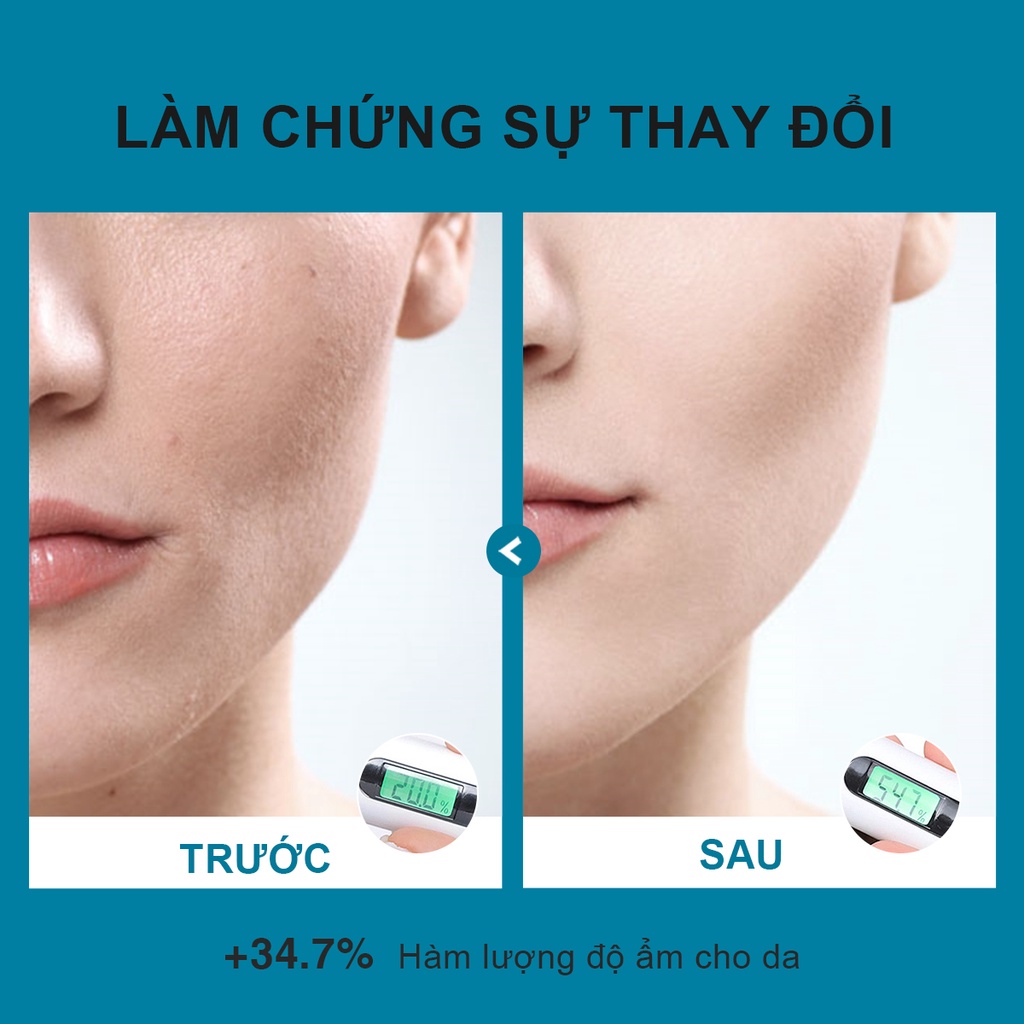 【210k Mã voucher：YOUNG】Kem dưỡng da Youngbook cấp nước dưỡng ẩm cho da mặt 25g | BigBuy360 - bigbuy360.vn