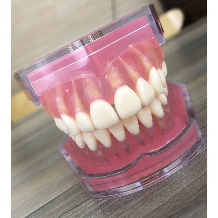 Mô hình răng toàn hàm có hiển thị chân răng, nướu cao su mềm